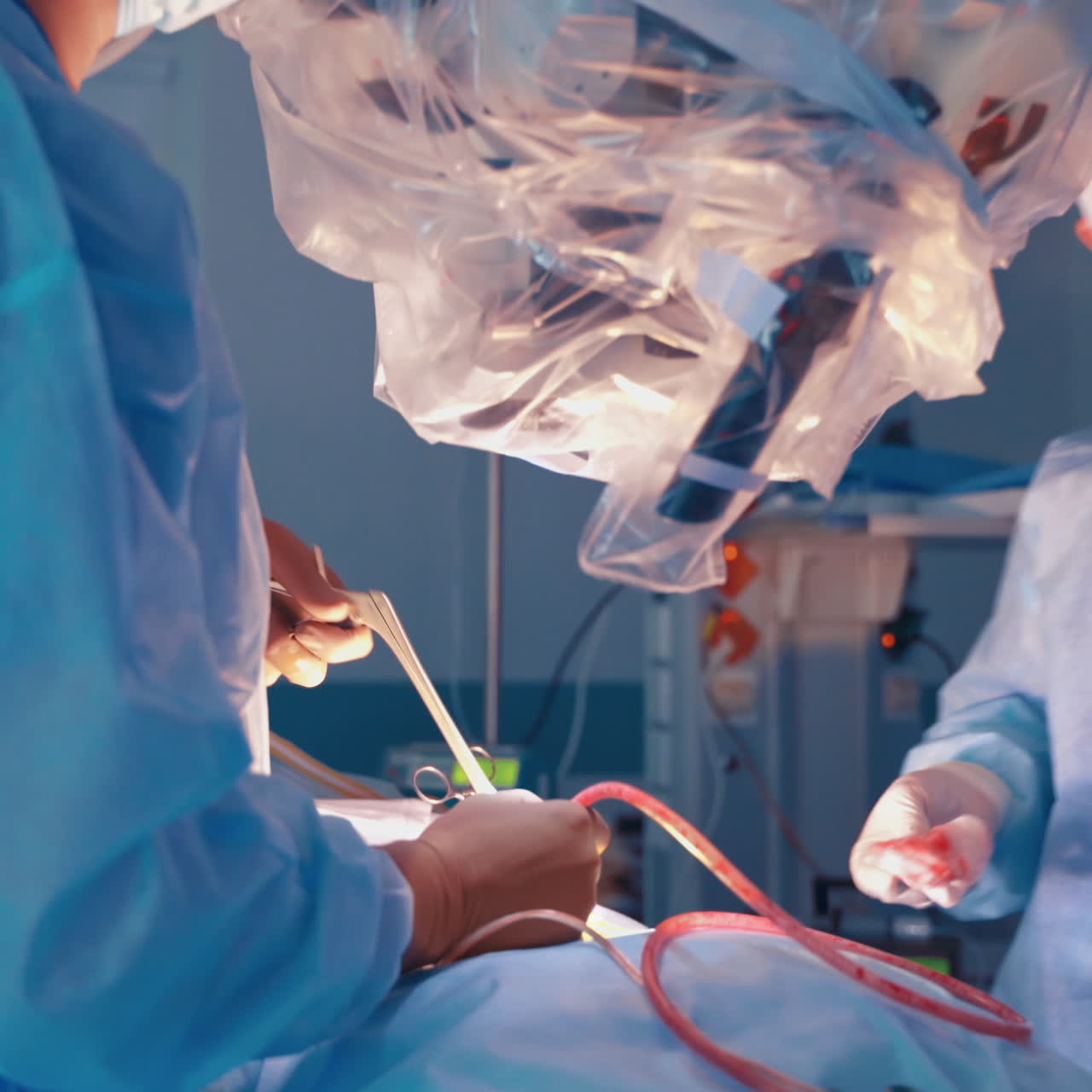 Operational process. Doctors in blue uniform performing surgery in the modern operating room of the hospital.