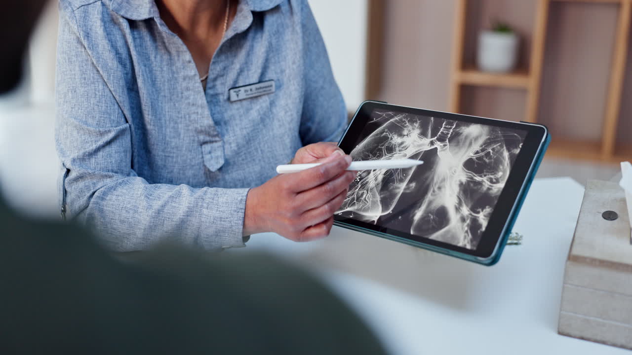 médico revisando las radiografías con el paciente