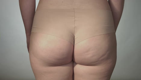 close up on woman buttocks with cellulite