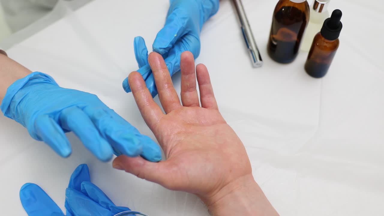 Medical examination of a patient's hand