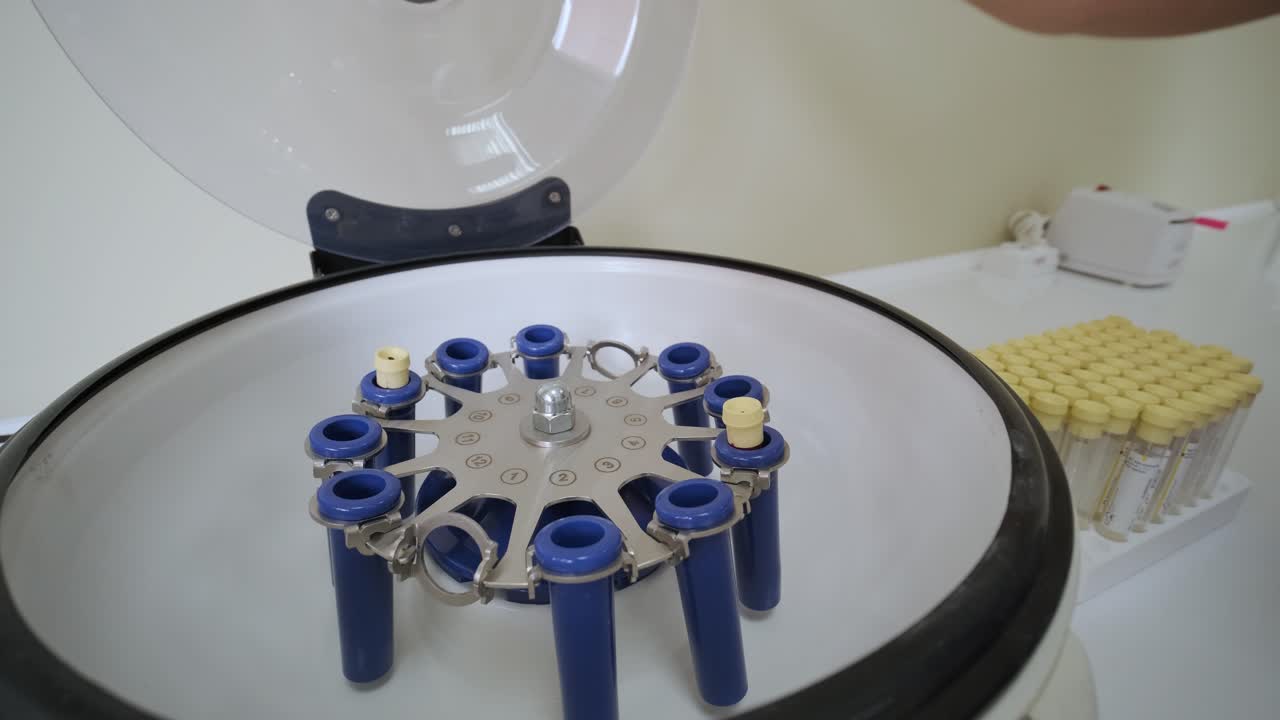 preparación de plasma rico en plaquetas. tubo con sangre en las manos. centrifugadora.