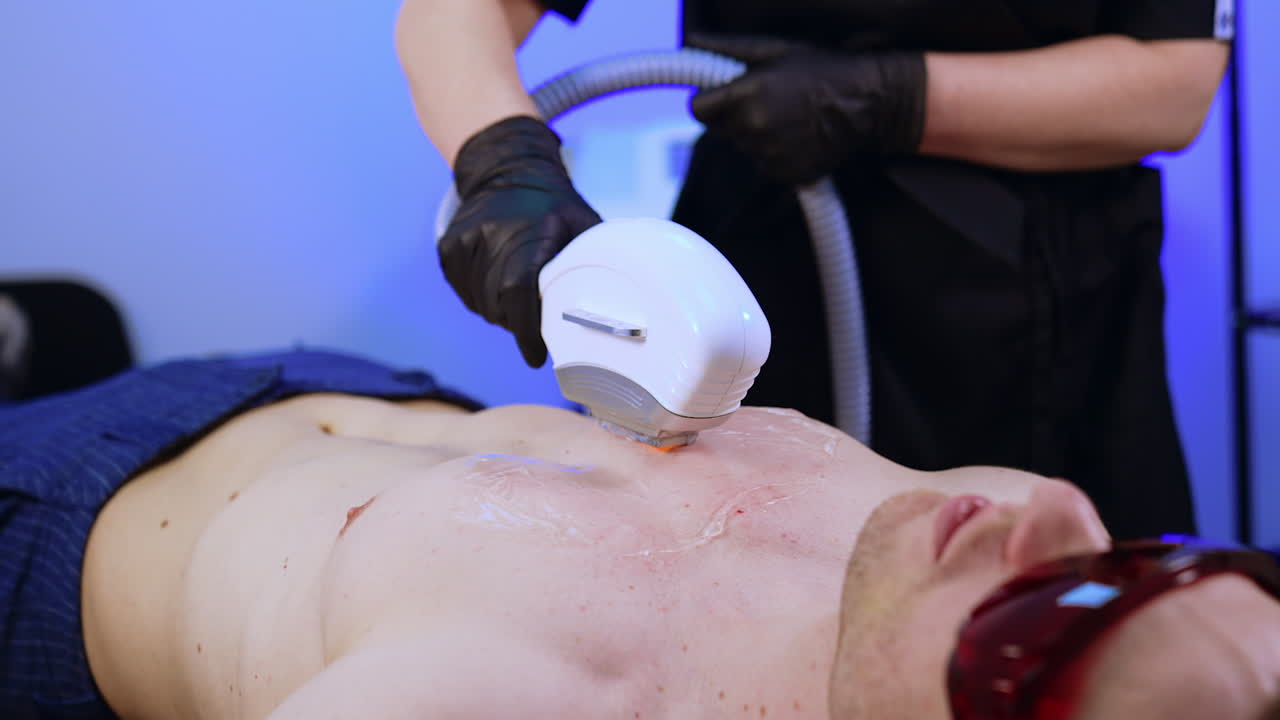 Laser epilator is moved by the male chest covered with gel. Man's eyes are protected with goggles.