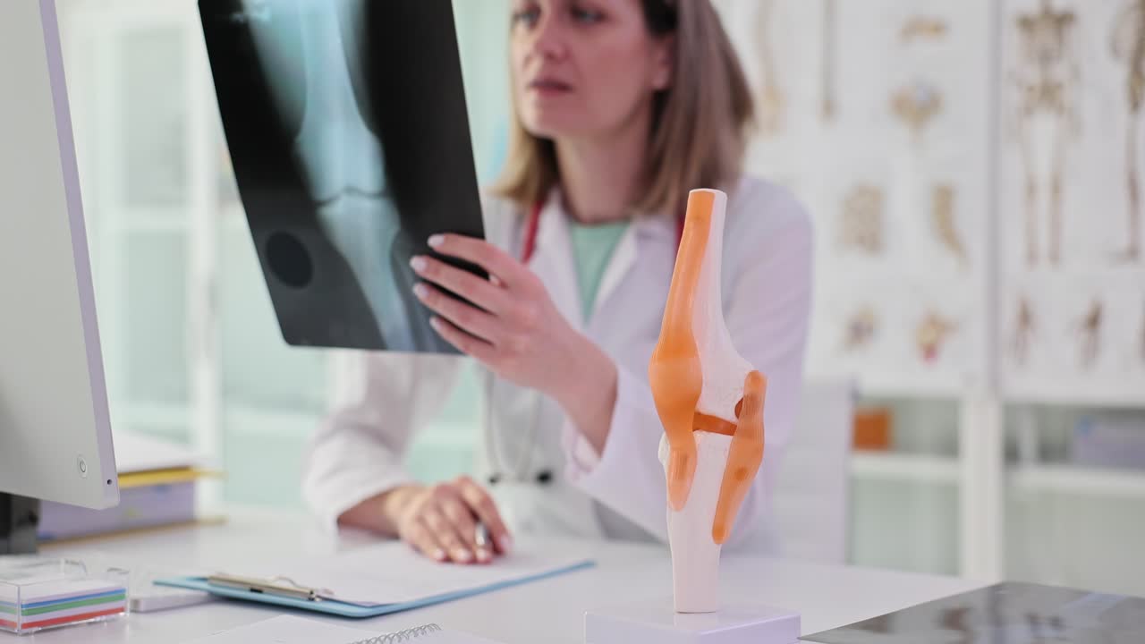 Female Doctor Examining X-ray Film with Knee Joint Model in a Medical Office