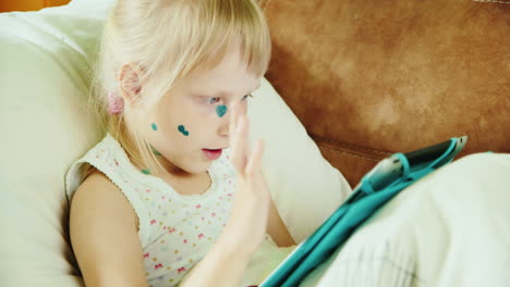 Girl-is-sick-with-chickenpox-lies-in-bed-with-a-tablet