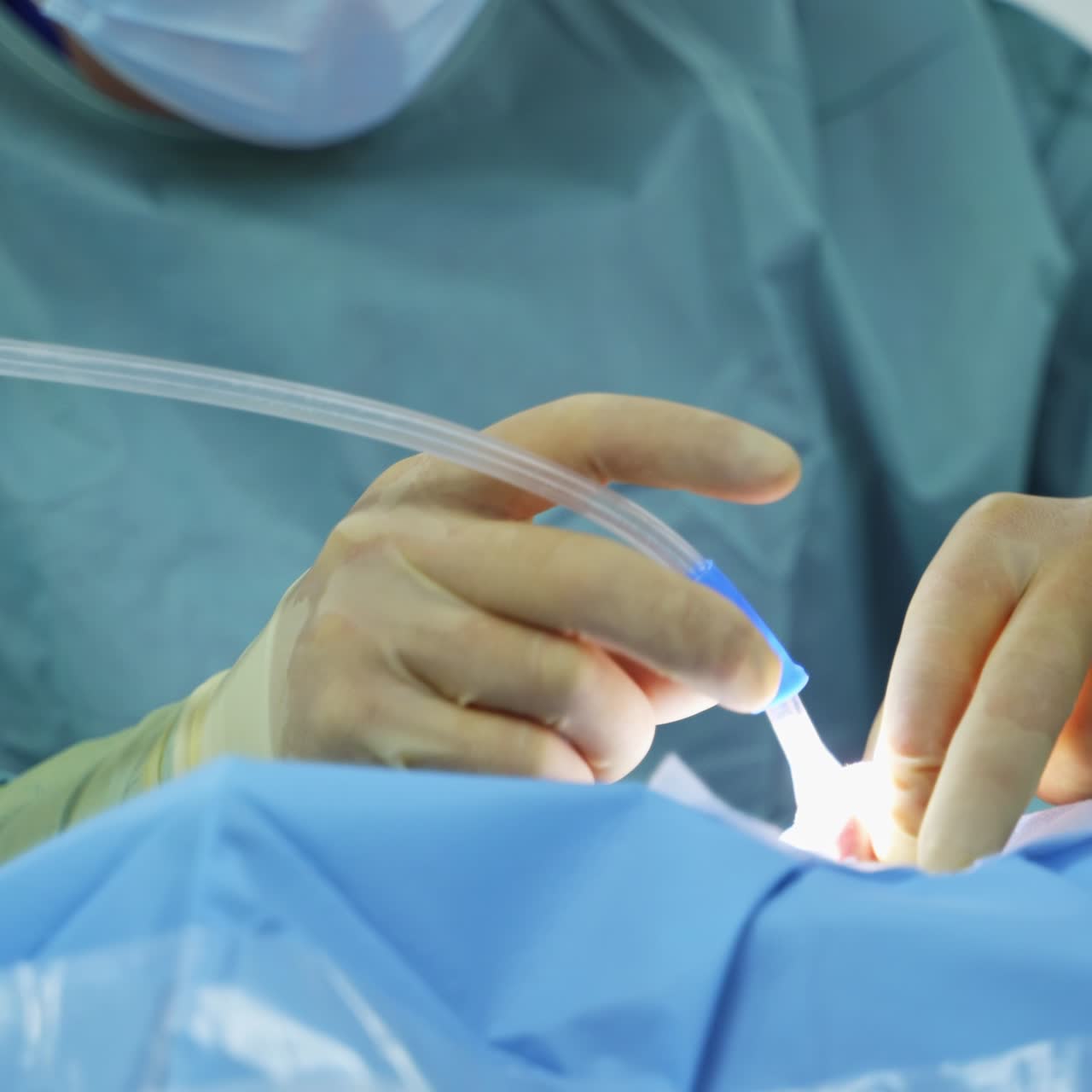 Otolaryngology doctor in funny cap and device glasses bent over the patient at operation. Specialist moves tool with long tube in the nose of a person