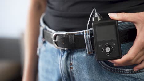 hand of diabetic female showing switched off insulin pump on her belt