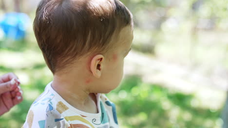 lovely baby boy outdoors. child having some red spots from mosquito bites and mom's hand applies ointment. close up.