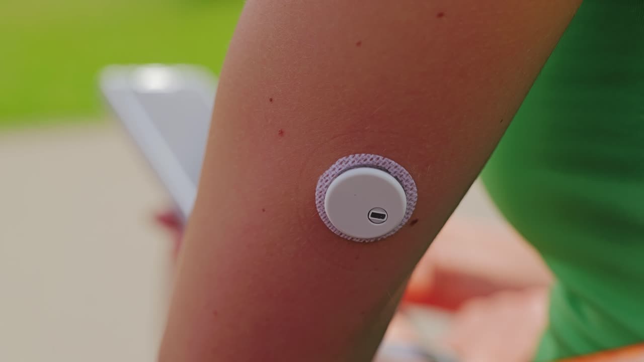 Close up glucose sensor on arm connected to phone app for real time health data