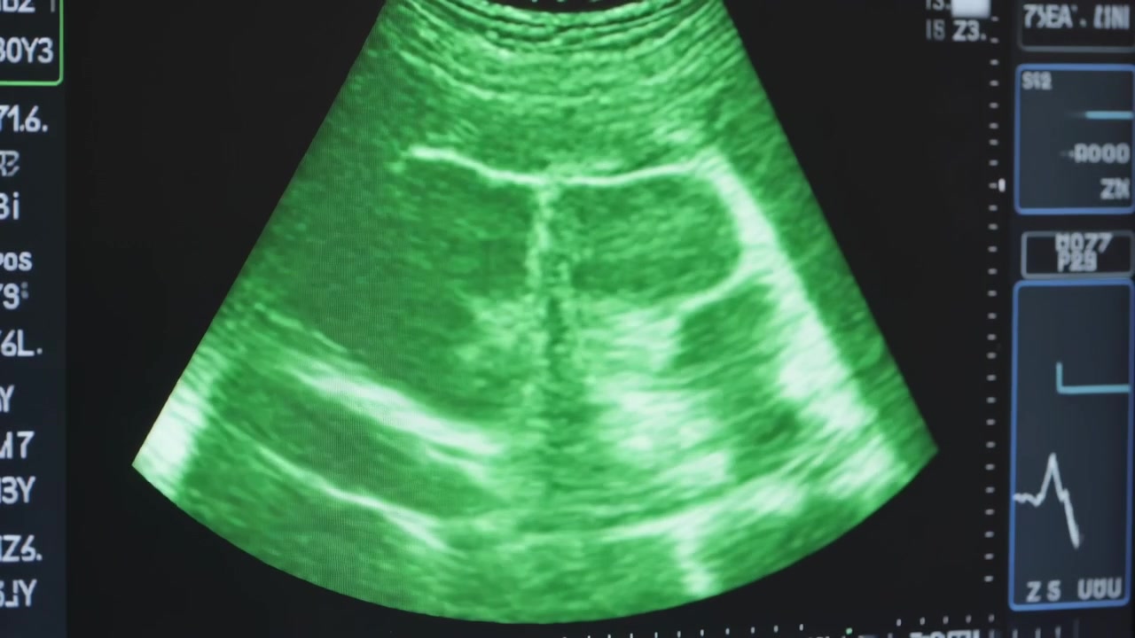 Displaying sector scan on monitor in clinic, system holding plane for review with waveform metrics