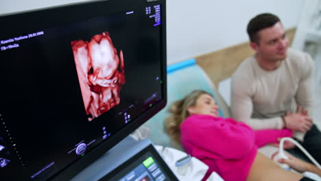 monitor with baby image on. checked woman and her husband are at backdrop. top view.