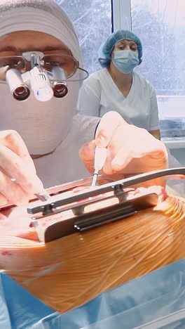 cirujano con asistente lleva a cabo una cirugía cardíaca. médico con binoculares y enfermera trabajan juntos durante una complicada cirugía de derivación de la arteria coronaria en el hospital