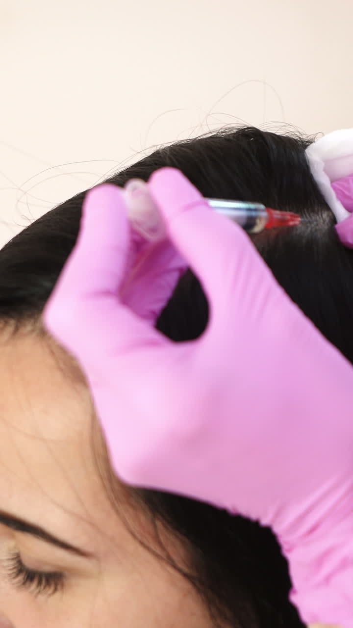 Female beautician makes injection of vitamins and minerals in the scalp. The concept of hair loss. Vertical video