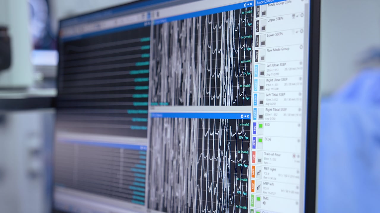 Analysis of brain work of a patient during the neurosurgical operation. Close up view on the monitor working at surgery.