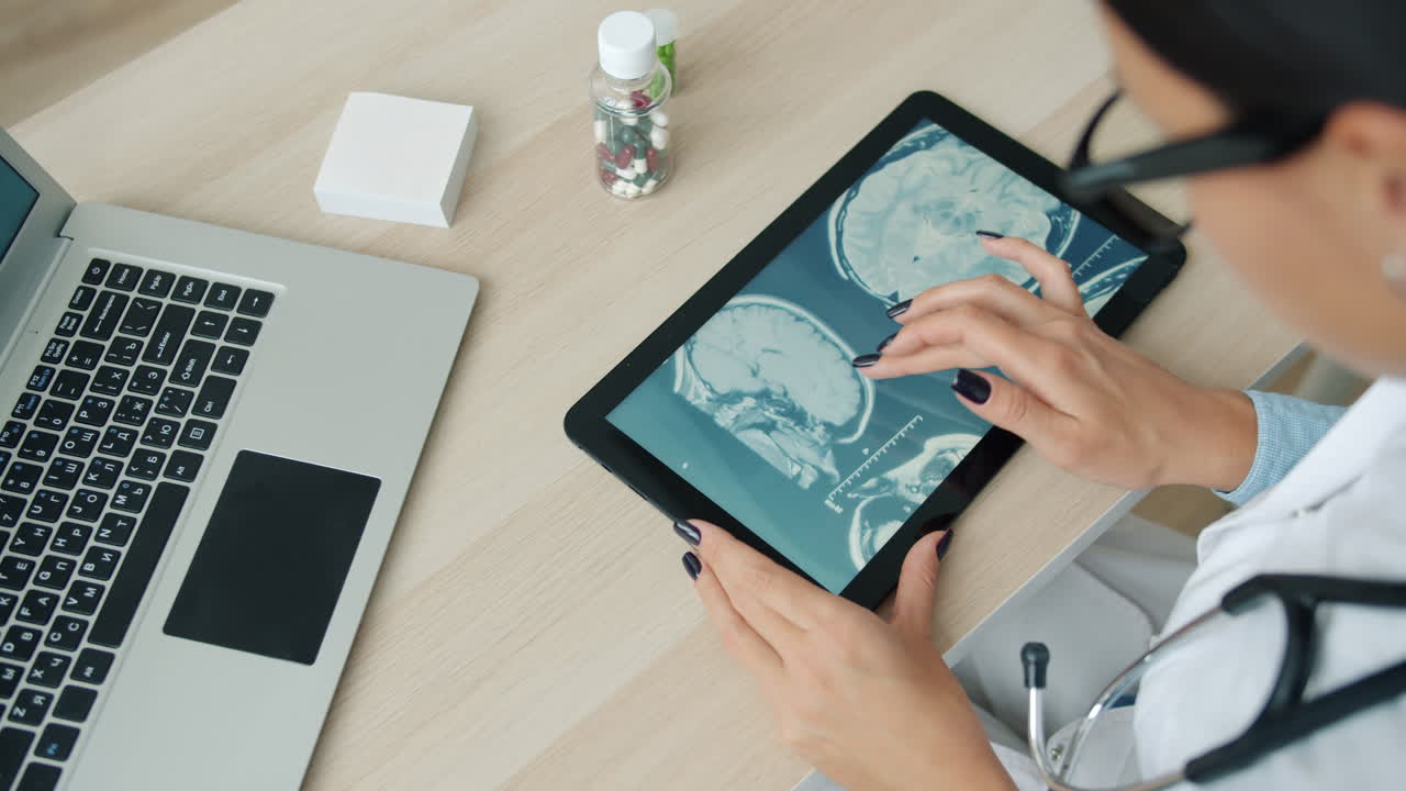 Doctor reviewing brain scans on a tablet