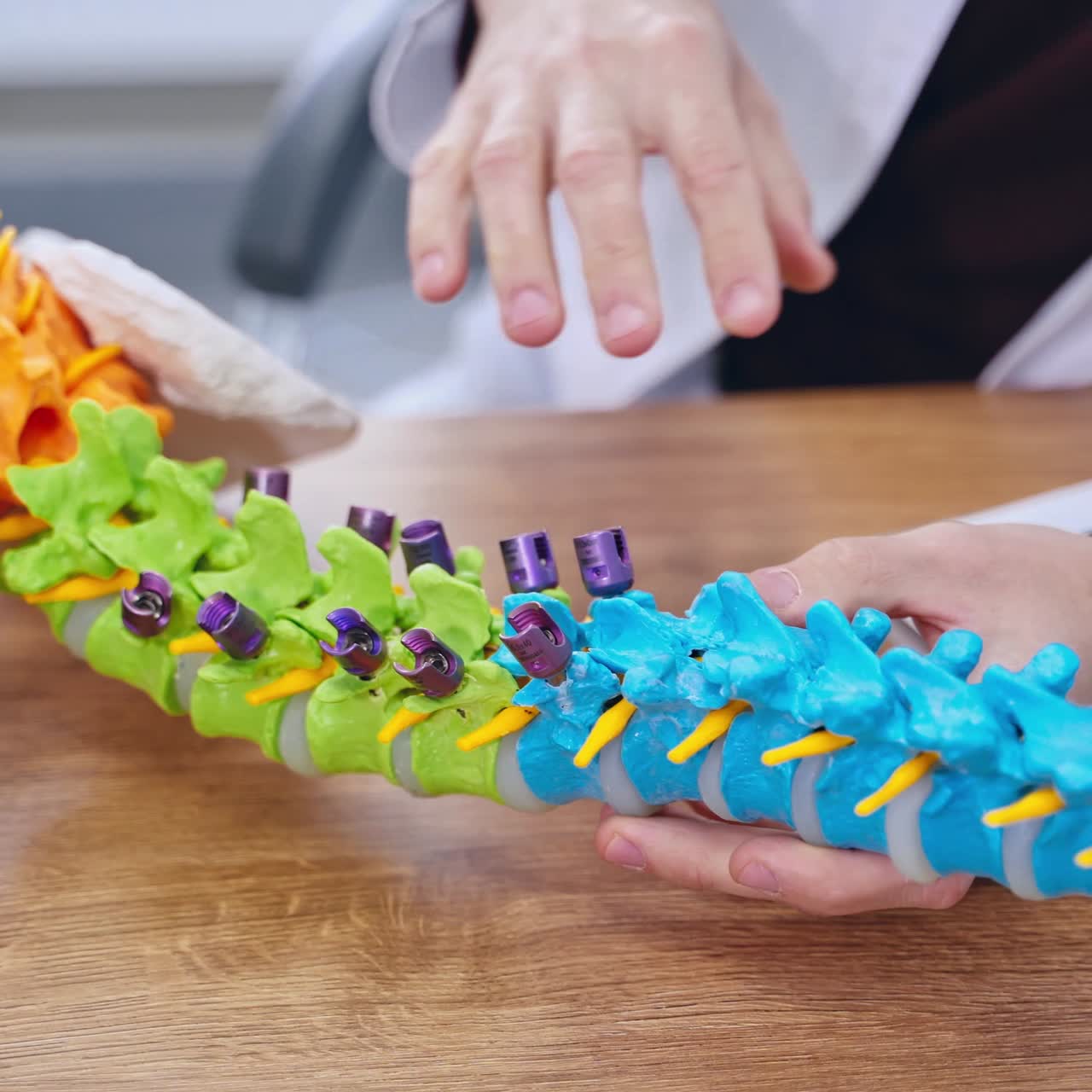 Discussing medical issues. Spine fixation systems. Spinal surgery