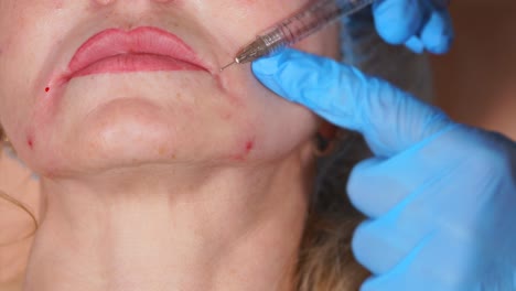 procedimiento de inyección facial