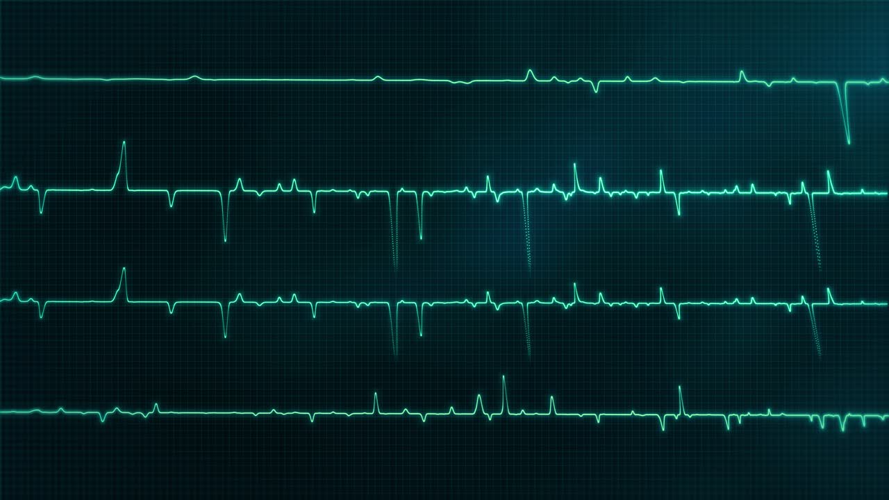 Animación de Monitor de ECG de Latido Cardíaco: Bucle de Fondo de Signo Vital de Electrocardiograma Médico