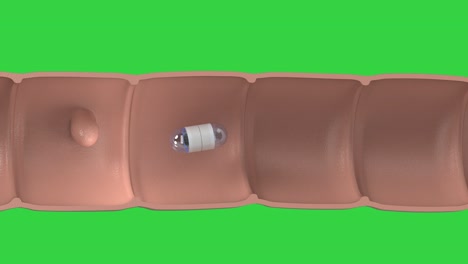 capsule endoscopy