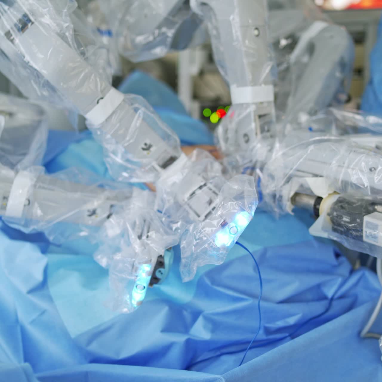 Futuristic robotic arms doing a surgery. Modern medical equipment in the surgery room. Minimally invasive robotic operation in clinic.