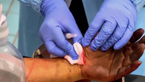 Close-up-of-an-open-wound-on-the-wrist-being-cleaned-with-cotton-wool-by-medical-personnel