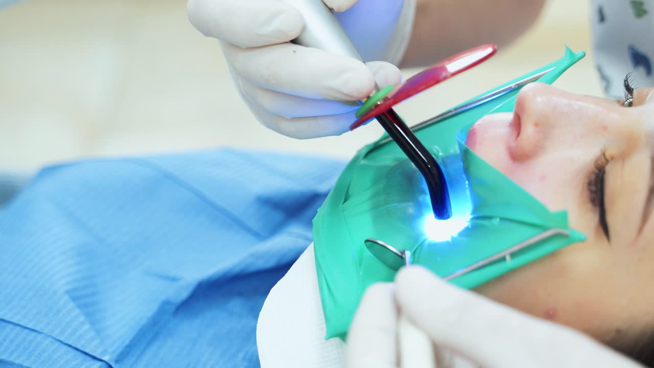 A doctor treats a tooth with a photopolymer lamp. The procedure for filling a tooth in a clinic