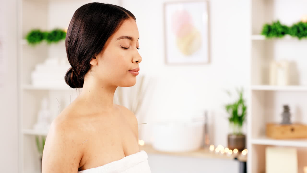 침술 명상, 스파