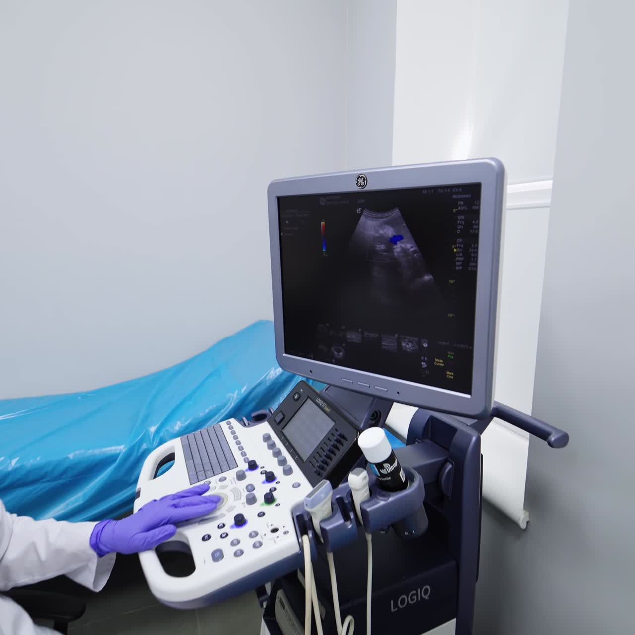 Female doctor in glasses performs check up for a female patient. Ultrasonic diagnostics for inner organs