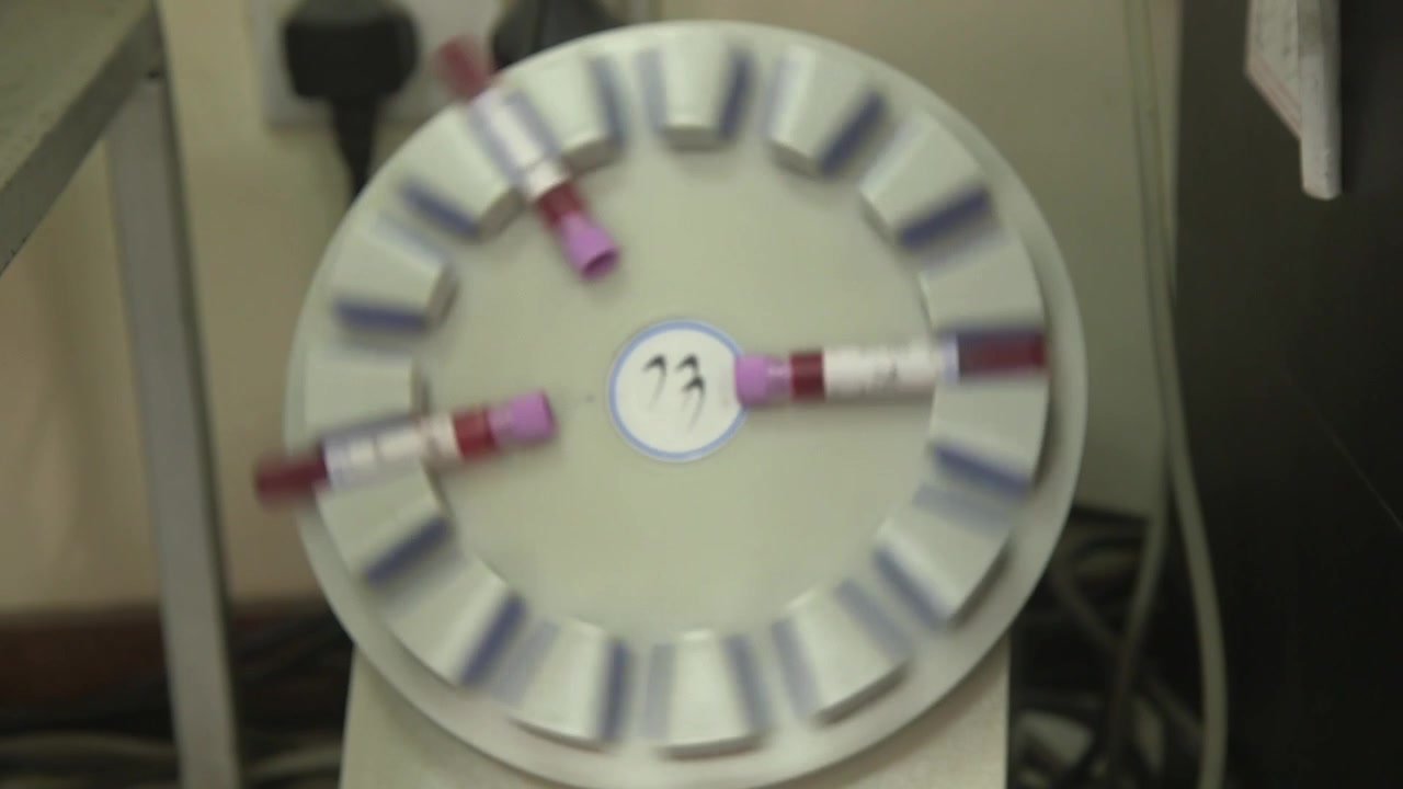 Hospital laboratory equipment with blood sample tubes arranged in a circular analyzer inside a medical lab.