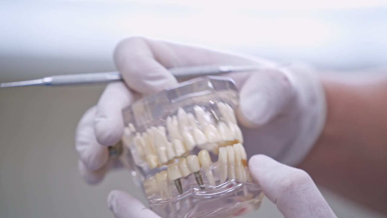 Modern jaw model in dentists hands. Close-up artificial teeth. Medic in white sterile gloves. Stomatology concept.