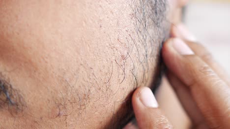 close-up view of a man's face with a pimple or blemish