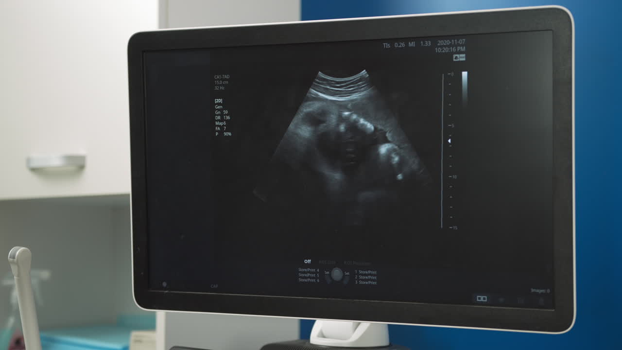 Ultrasound Image of a Fetus