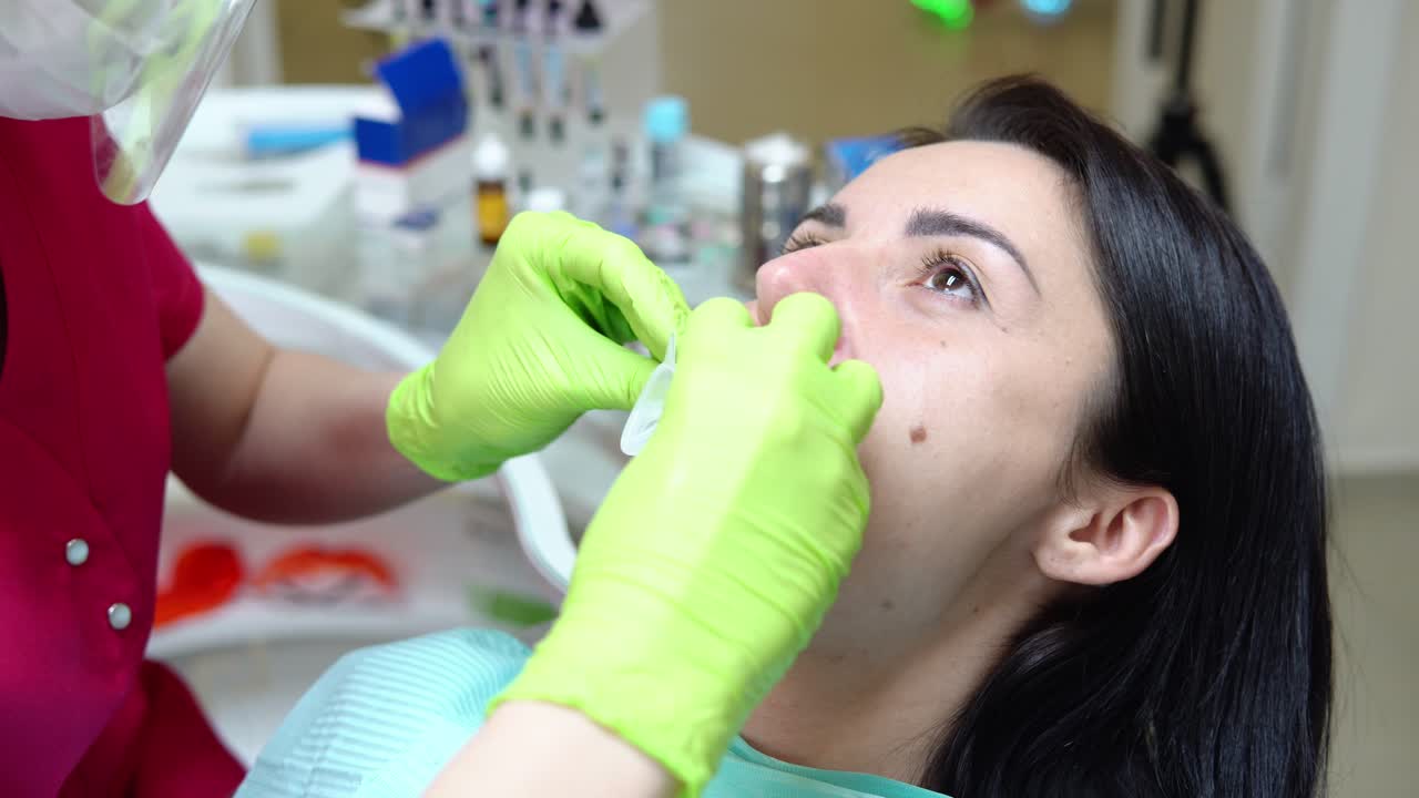 Closeup view of the dentist's hands putting rubber dam in a mouth of a female patient. Shot in 4k