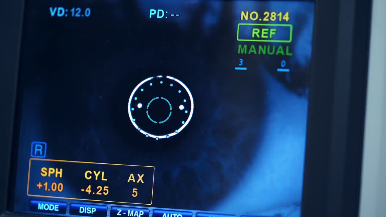 Eye operation monitor. Modern medical equipment in eye hospital