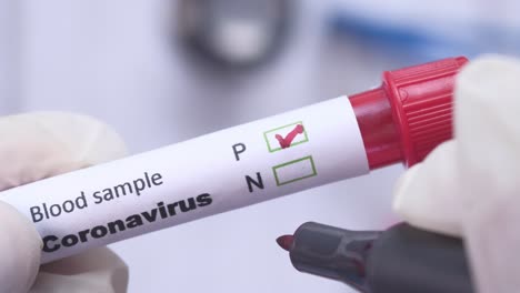 coronavirus blood sample testing