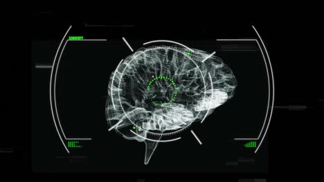 Animation-of-glitch-effect-and-scope-scanning-over-spinning-human-brain-icon-on-black-background