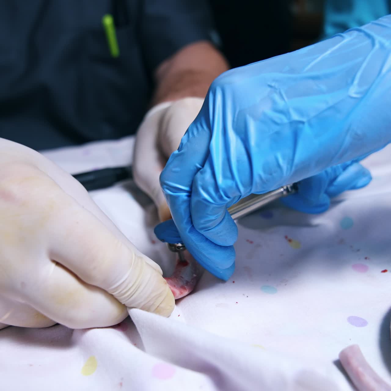 Male hands in white latex gloves hold the bone. Hands in blue latex gloves tightening the screw. Close up. Orthodontic concept
