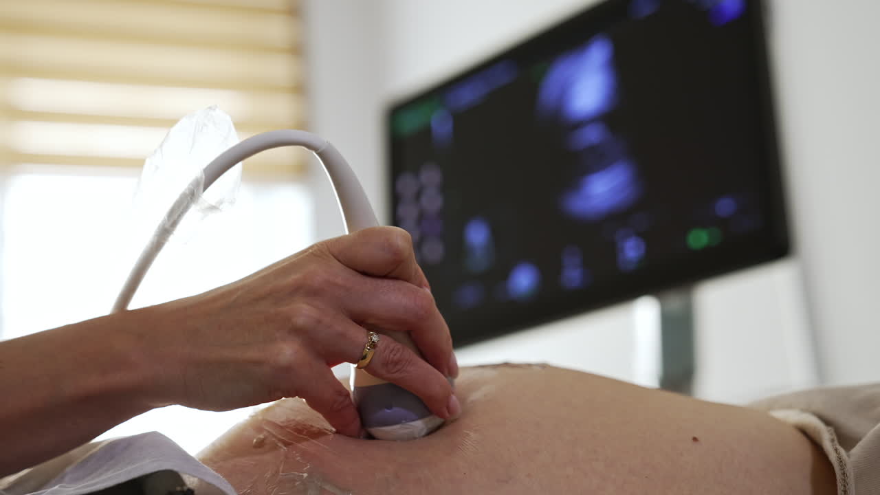 procedimiento de ultrasonido