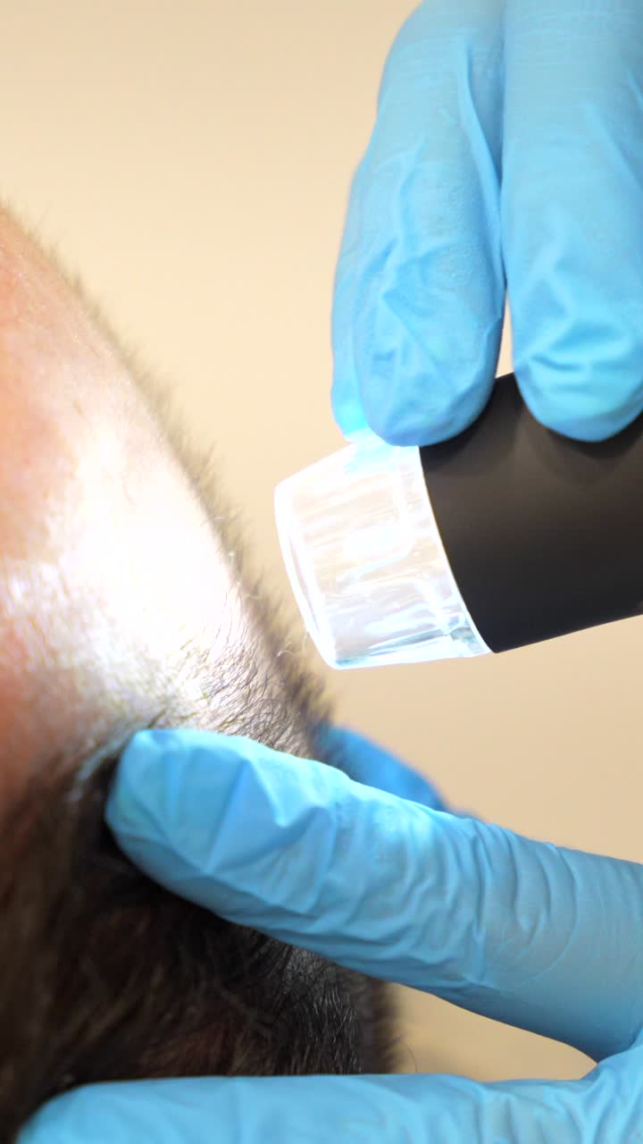 Scalp Examination and Hair Analysis with Trichoscopy
