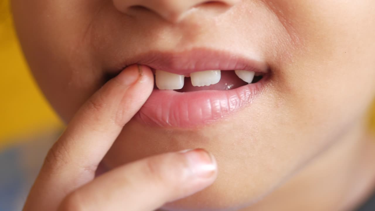 niño con un diente perdido