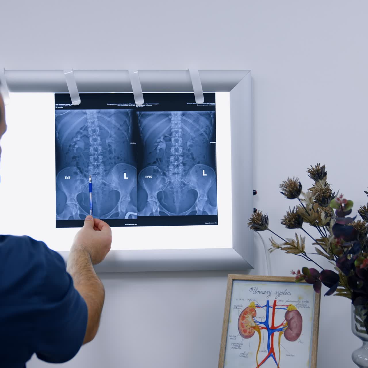 Obstetrician showing the x-ray scan of inner organs to a patient. Blonde woman in mask listens to a doctor and nods