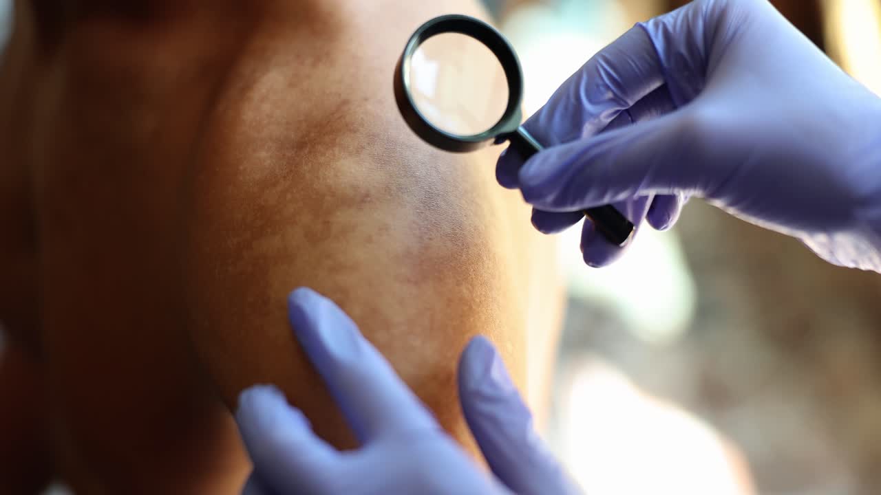 Dermatological Skin Examination with a Magnifying Glass