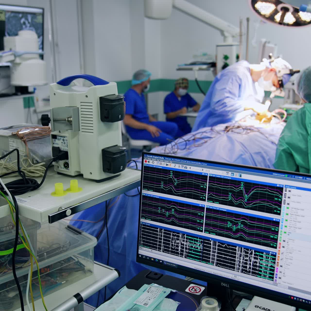 Computer monitor showing curves of patient's brain work. Surgical team operating at backdrop. Neurosurgery concept