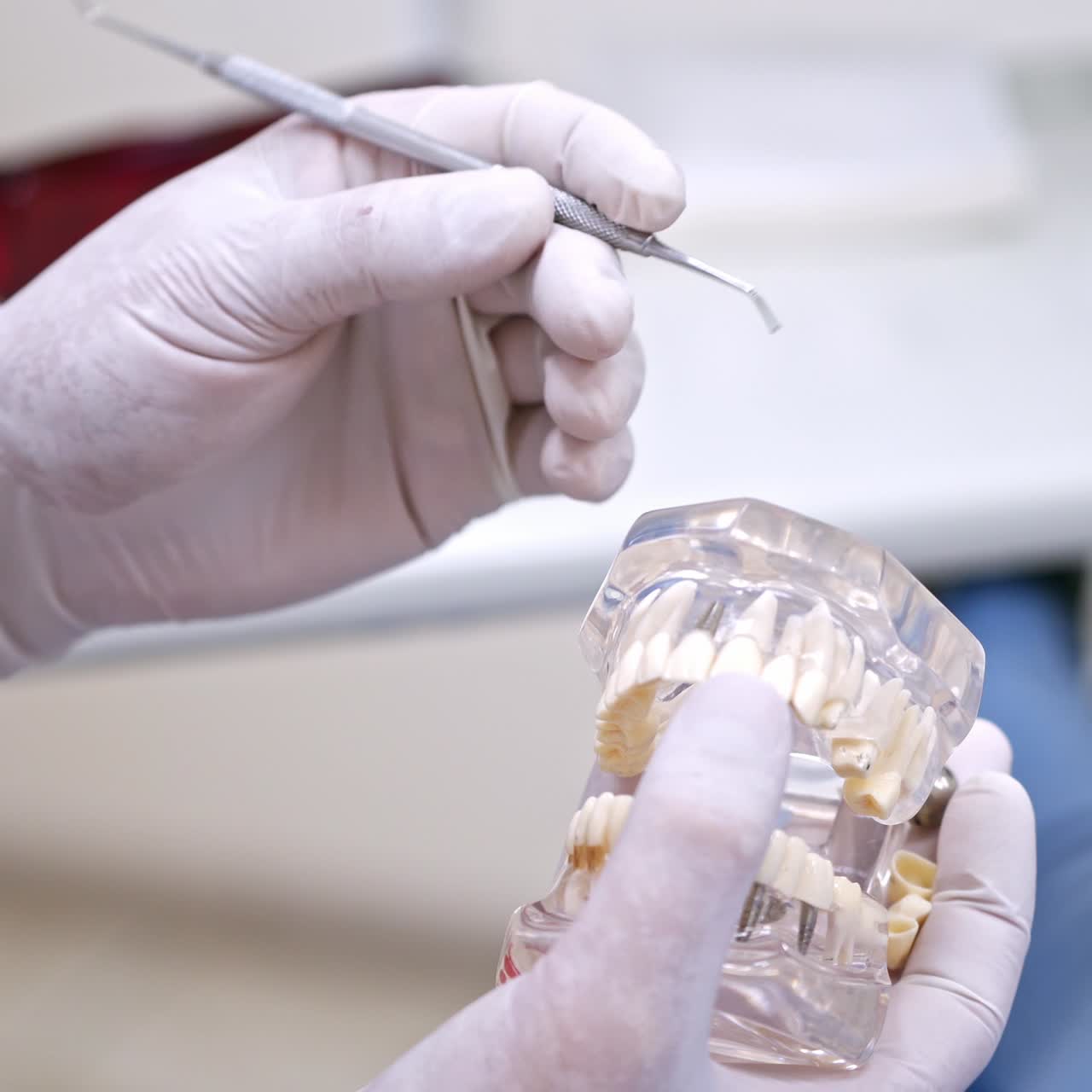 Dentist demonstrating tooth model