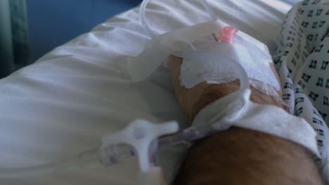 close-up of a patient wiggling his fingers for the first time since an accident