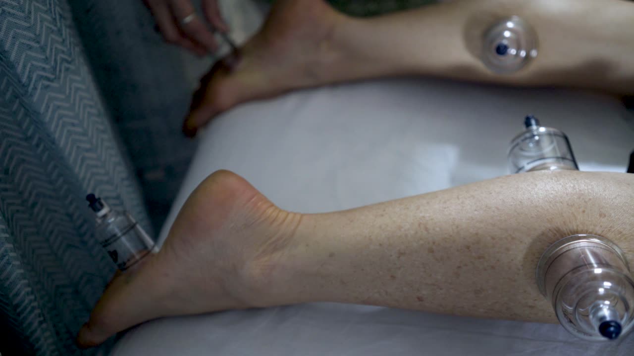 sesión de terapia de ventosas