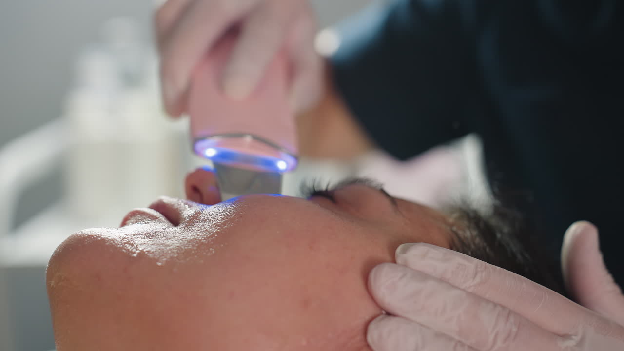 Skin expert wearing protective gloves using handheld extraction tool to gently remove blackheads and pimples from client face in close up spa setting during professional intensive acne treatment
