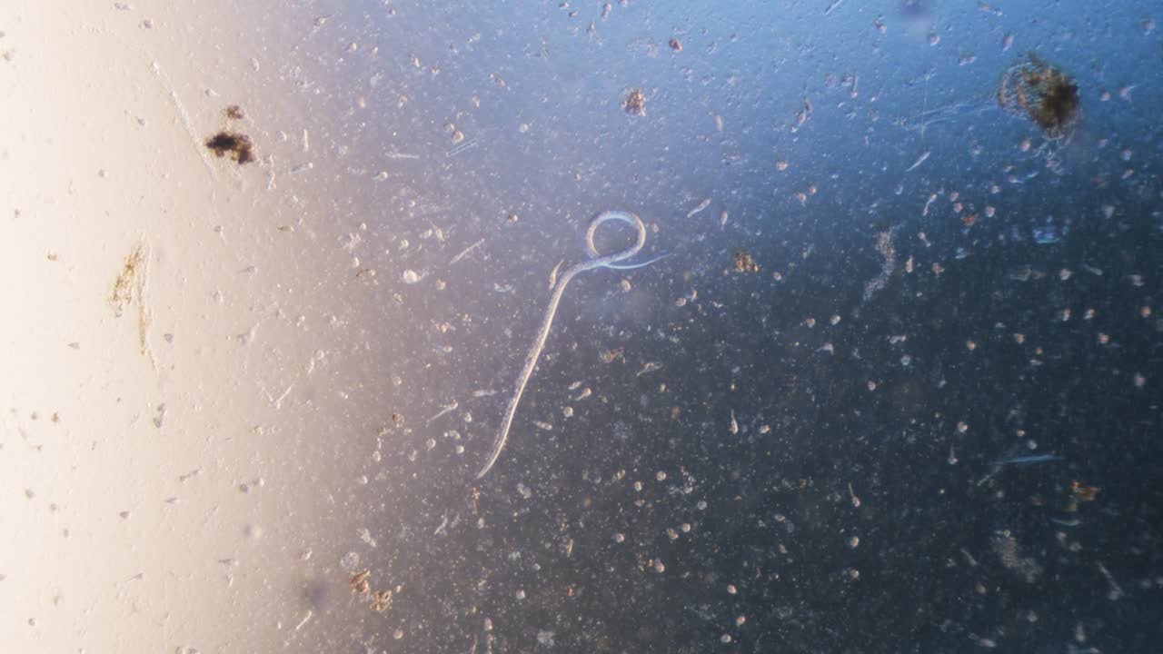 gusano parásito nematodo en microscopio campo brillante