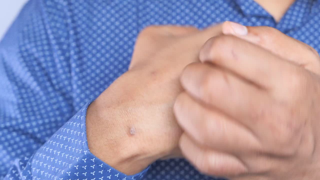 Injured Hand
