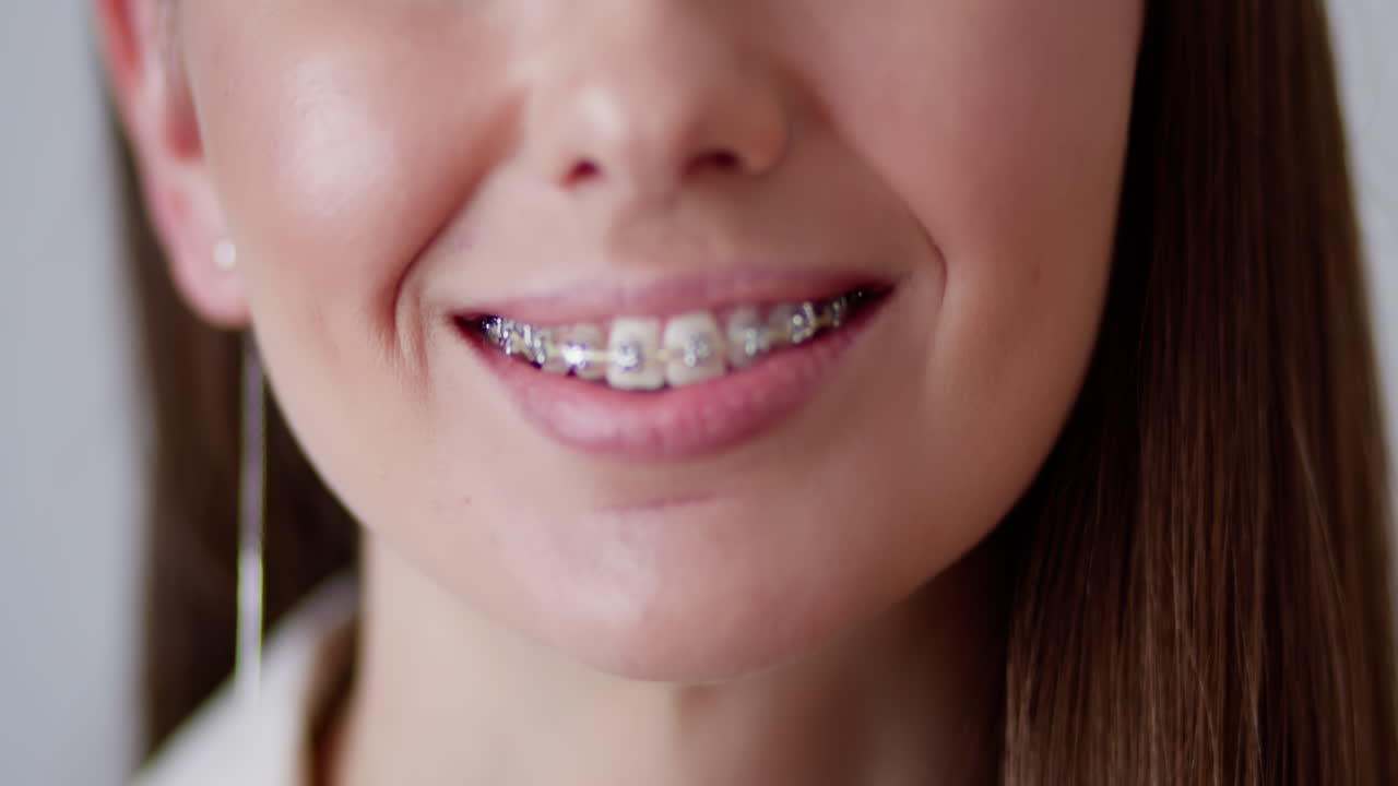 Woman with Braces