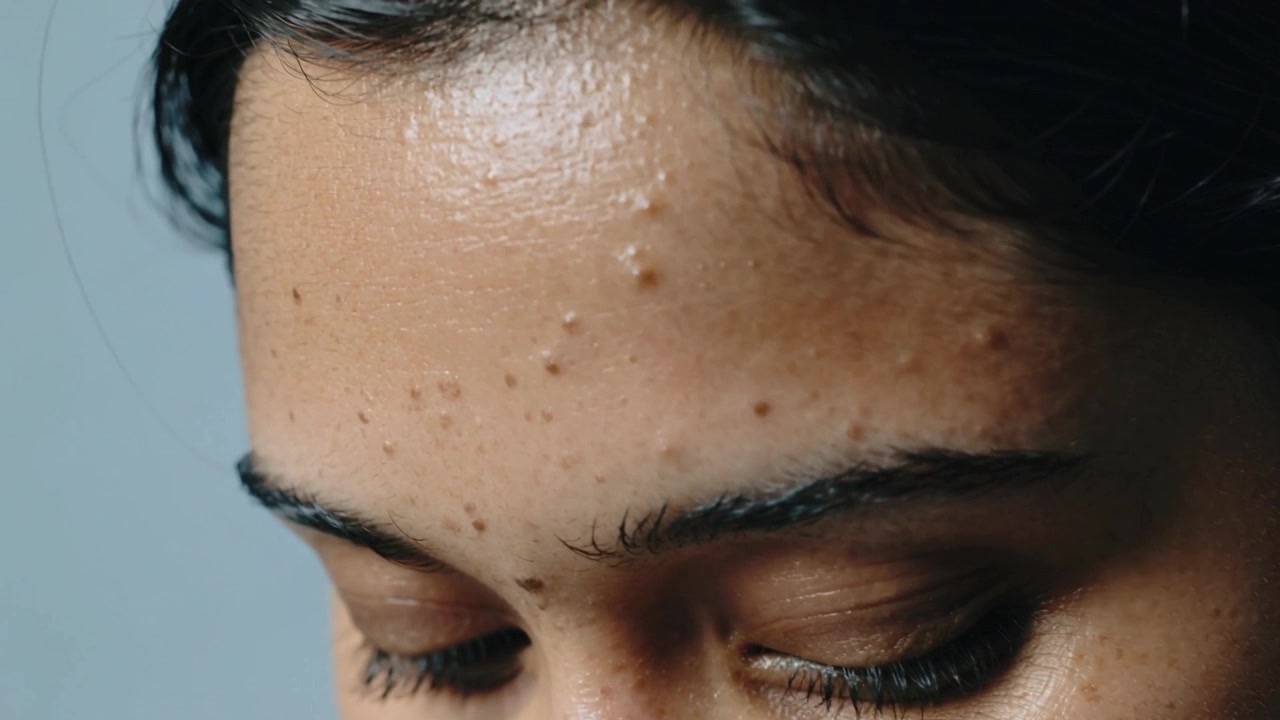 Testa di donna adulta inclinata che rivela protuberanze sulla fronte e occhi chiusi in studio, con ciocche di capelli.